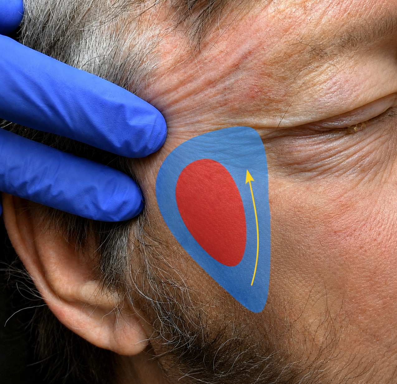 Educational reconstruction overlay for Eyelid & Facial Reconstruction