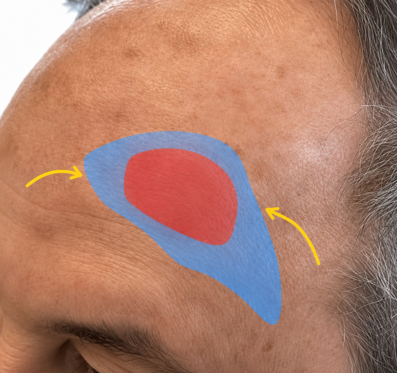 Educational reconstruction overlay for Facial Reconstruction