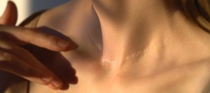 Scar Minimization After Skin Cancer Surgery | Aesthetic Eye & Surgical Arts Sarasota, FL