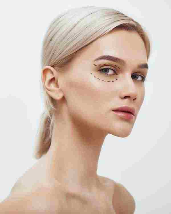 Upper & Lower Blepharoplasty at Aesthetic Eye & Surgical Arts in Sarasota, FL